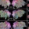 科学家绘制大脑结构图 清晰呈现颅脑内成像情况